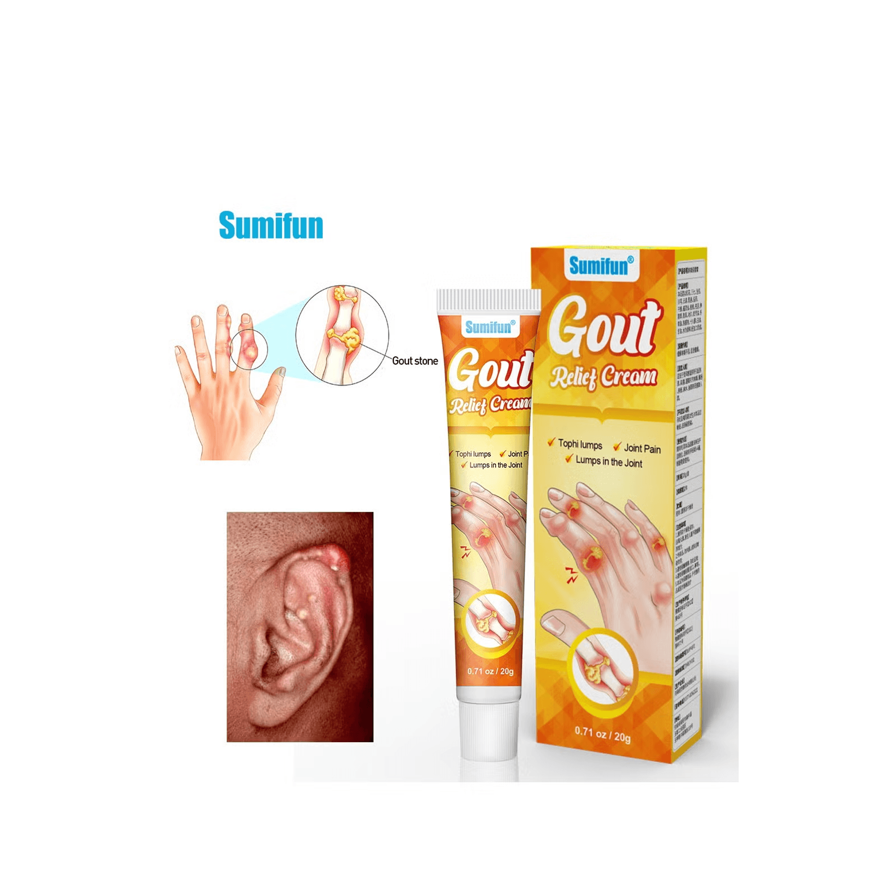 Gout Relief Cream - 20g